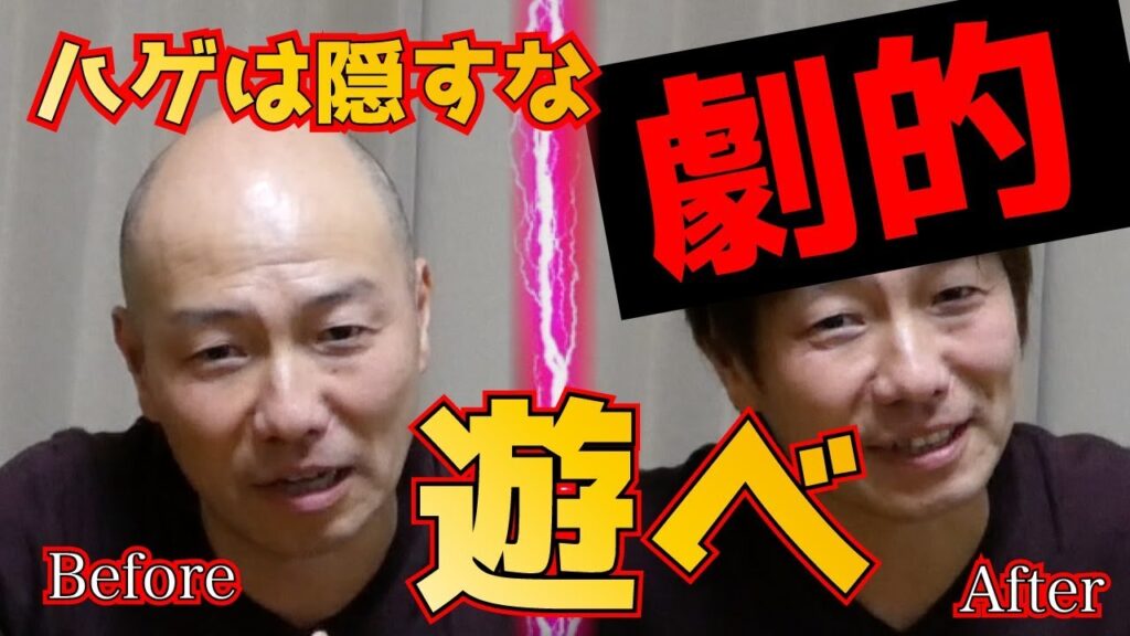 【Katsura】劇的ビフォー＆アフター！ハゲなんてこわくない！カツラTVついに始動！薄毛に悩んでいる方は是非見てください。【ウィッグ】【wig】【假发】