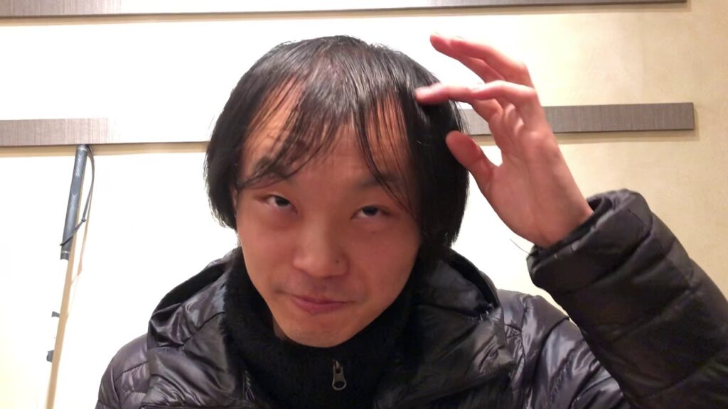 アートネイチャーで100本無料増毛体験をしてきたよ。笑（若ハゲ対策）