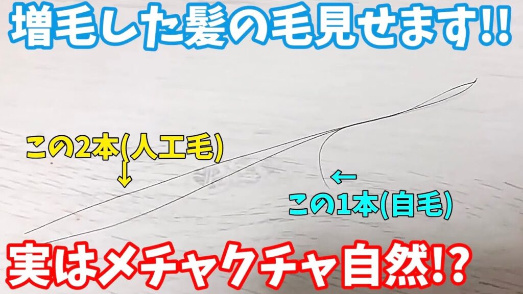 【EP8】アートネイチャーのマープ(MRP)で増毛した髪の毛見せます