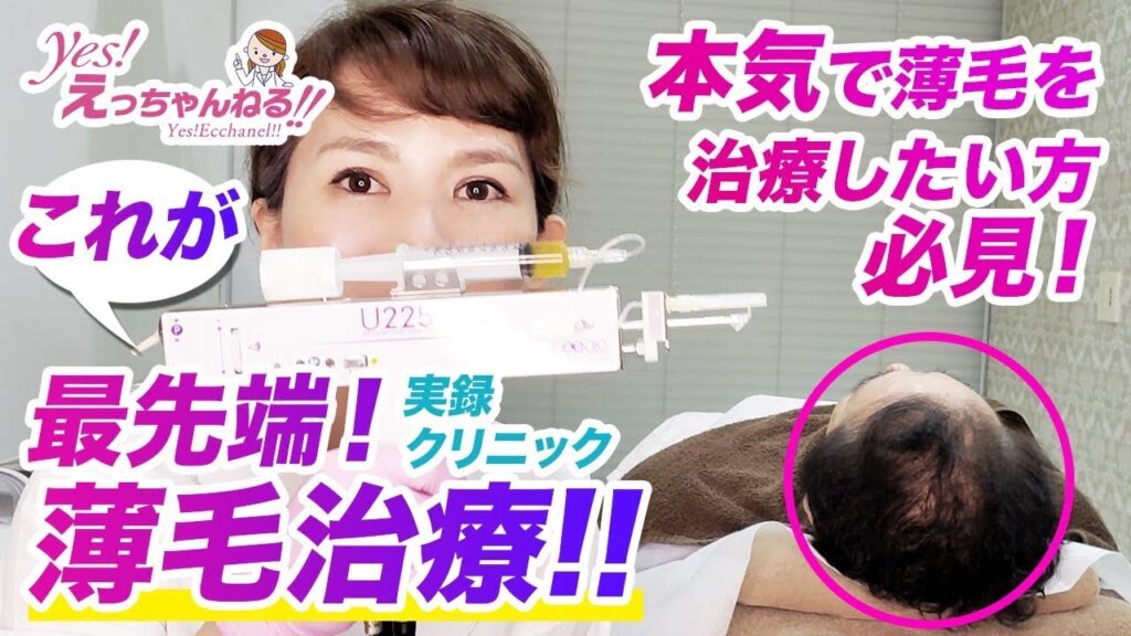 これが最先端の薄毛治療です【本気で薄毛を治療したい方必見】