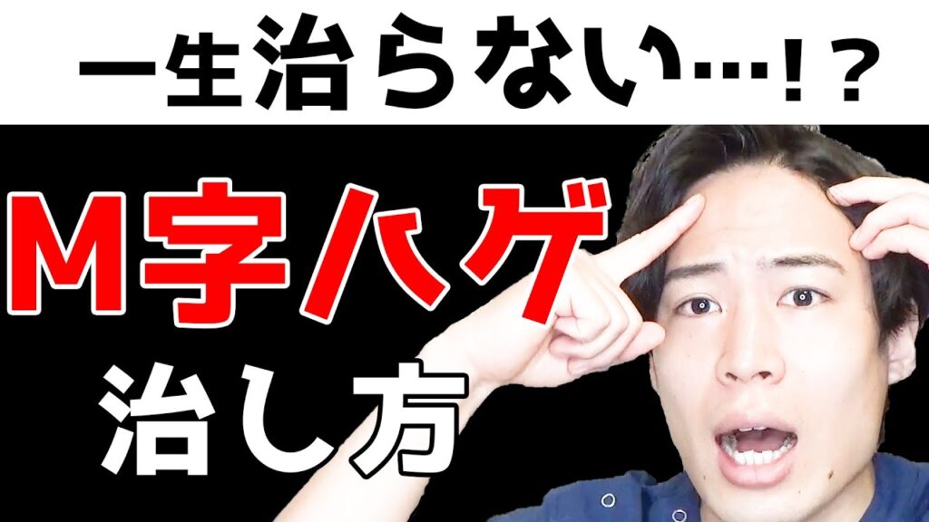 【必見】M字ハゲ、前髪ハゲは治るの?どう対策するべきか解説します。