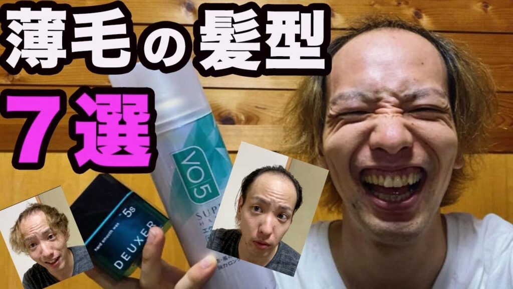若ハゲが1番似合う髪型は何か検証してみた【薄毛の髪型7選】