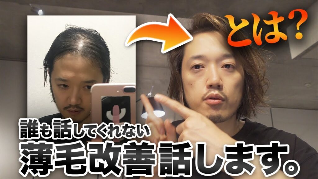 AGA治療に行く前に！今すぐ出来る髪が生えてくる生活習慣5選！