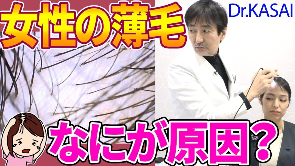【女性の薄毛は治る】抜け毛の原因はこれだった！きれいな髪を目指して【湘南美容の医師が解説】