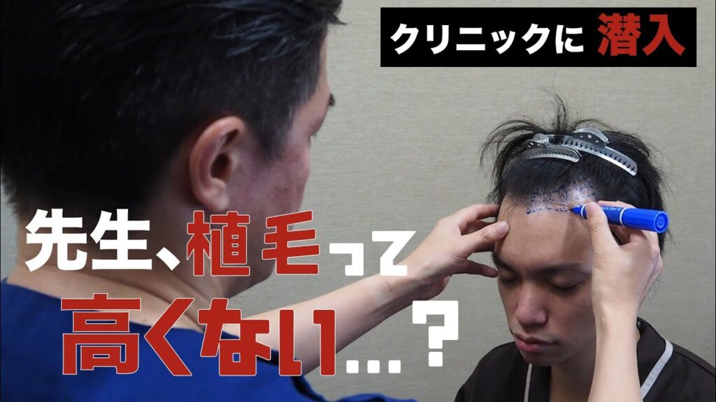 【クリニック潜入】自毛植毛の費用について院長先生に聞いてみた