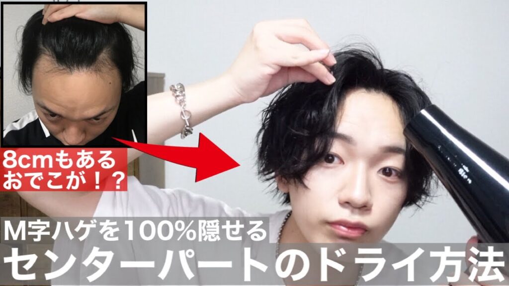 【徹底解説】M字ハゲを100%隠せるセンターパートのドライ方法!
