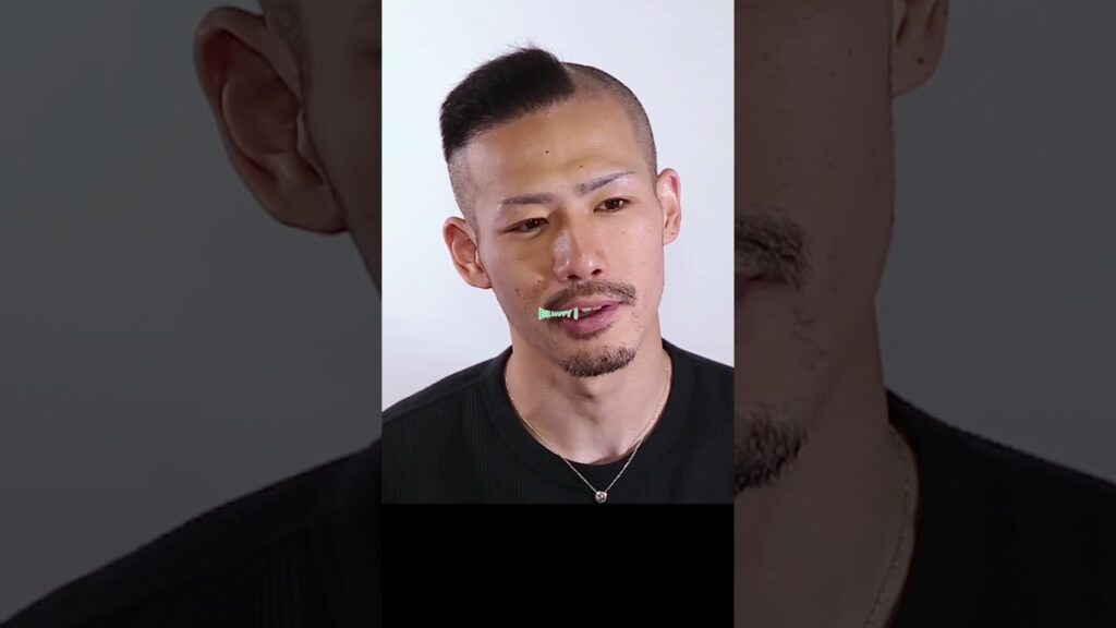 【薄毛治療】4000株 自毛植毛のビフォーアフター #Shorts