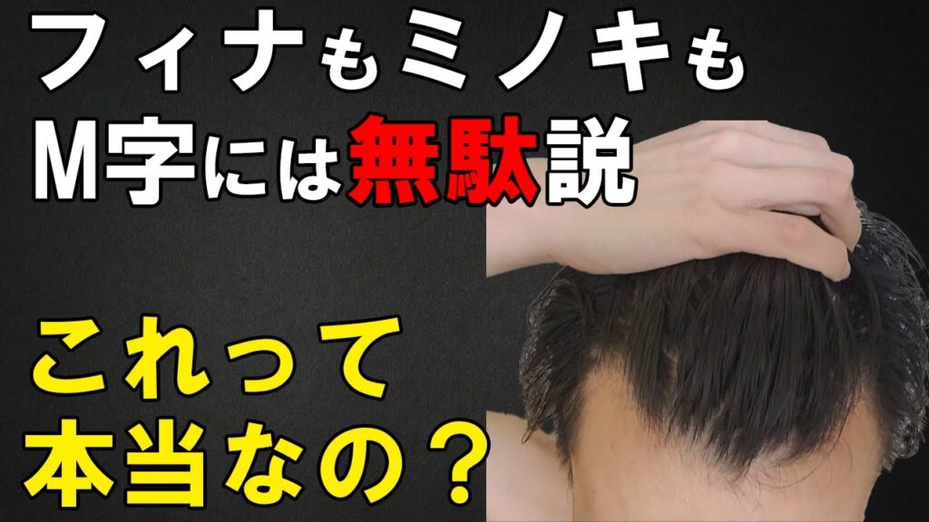 【薄毛治療入門】後退する生え際(M字ハゲ)を止める5つの方法