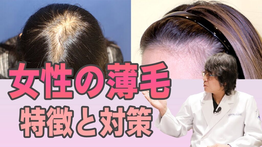 【自毛植毛】女性の薄毛に関する原因と予防を徹底解説