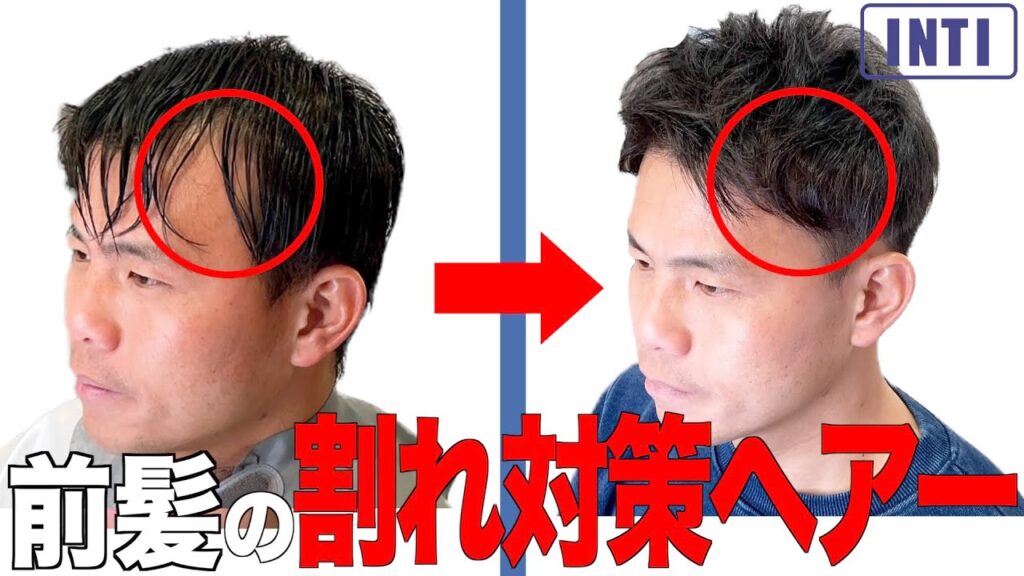 【薄毛】伸び切った前髪によるM字の割れをカットでカバー！！