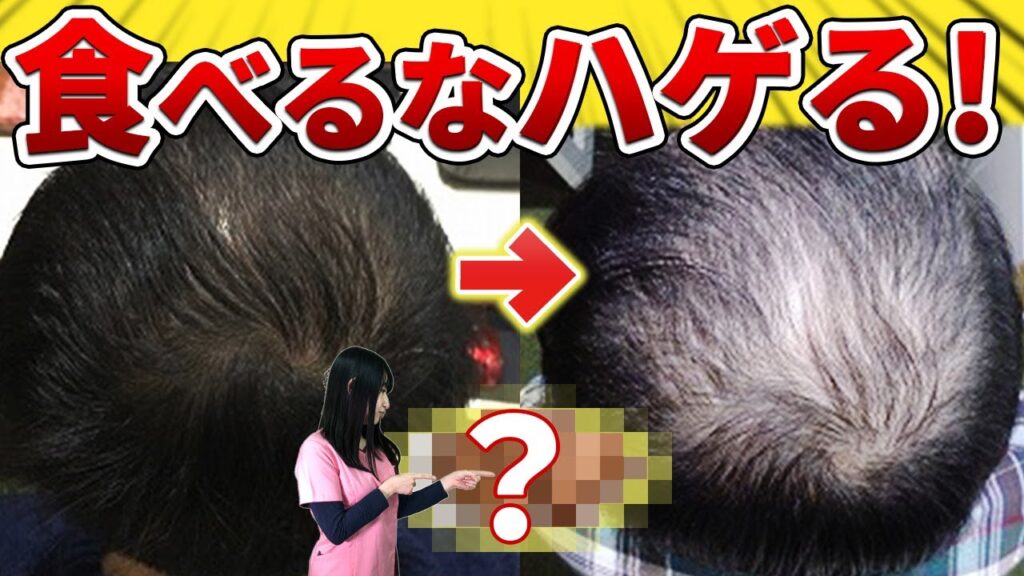 【即中止】AGAが進行する食べ物！！