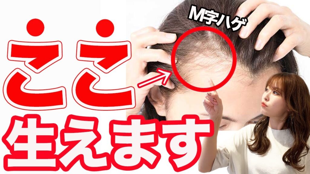 M字ハゲを治す方法！今からでも遅くない薄毛対策！