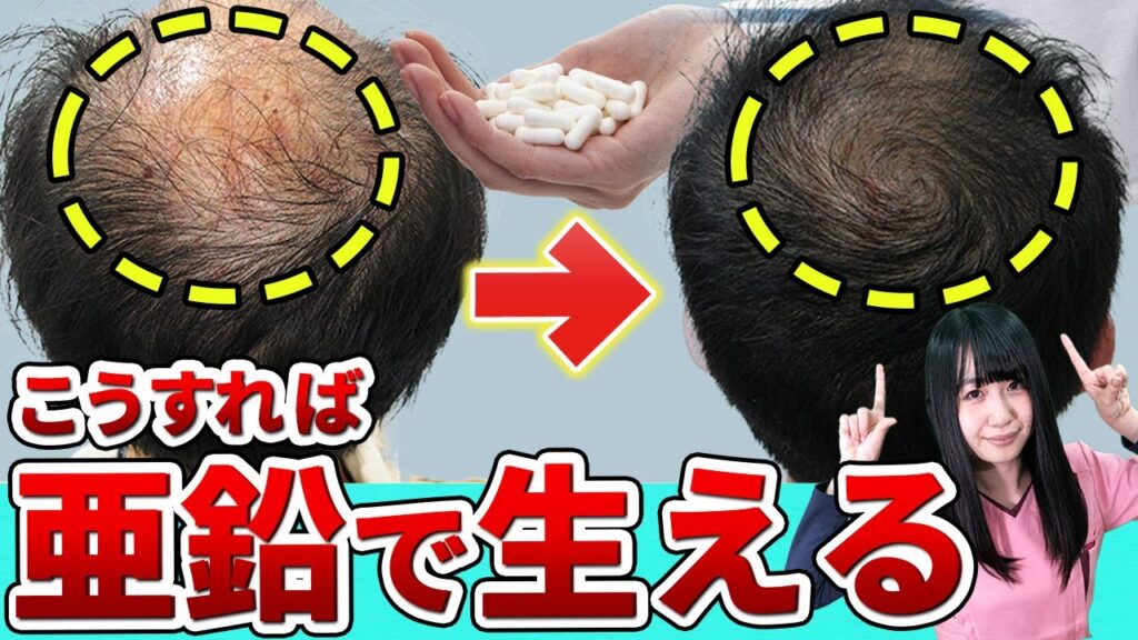 【警告!!】亜鉛サプリを摂るなら絶対にやってはいけない3つの事