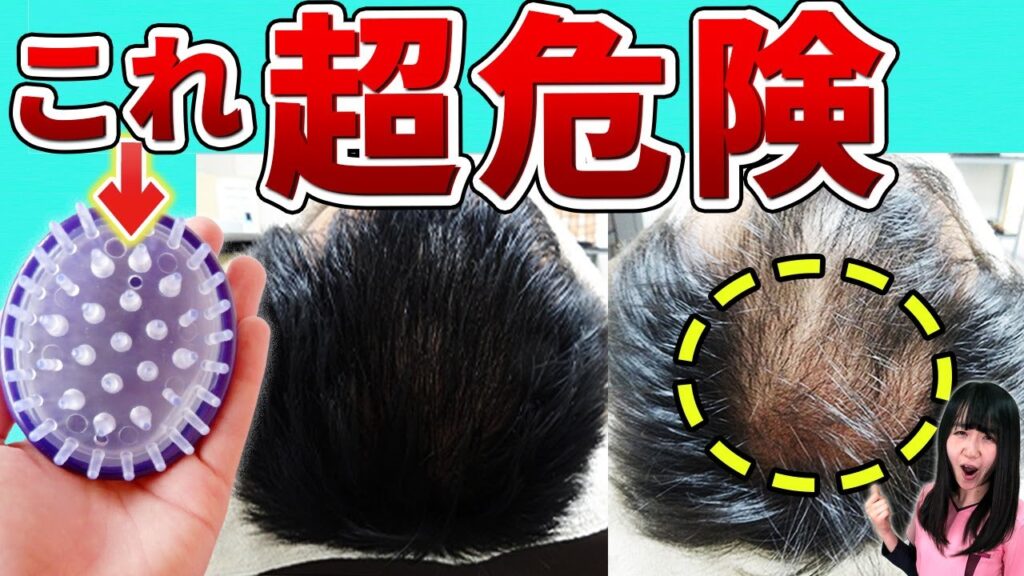 【発毛のプロに聞く】シャンプーブラシのメリット・デメリット～髪が生えるのに効果的な使い方と選び方～