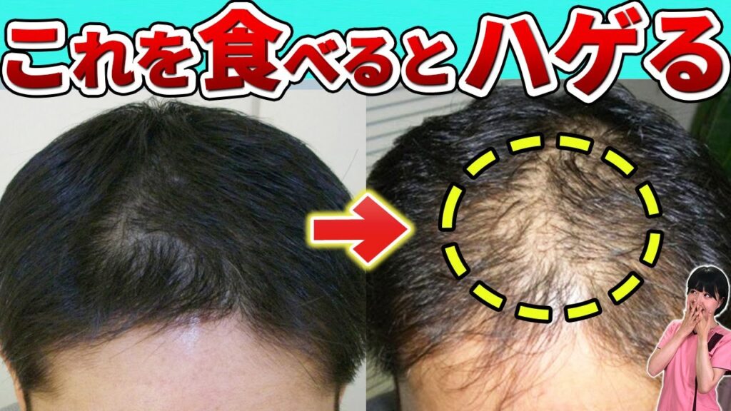 【恐怖】薄毛を引き起こすヤバイ食べ物3選【5分で解説】
