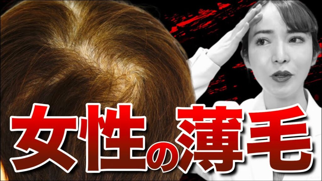 【AGA】女性の薄毛治療の効果と治療方法を経験者の医者が解説！