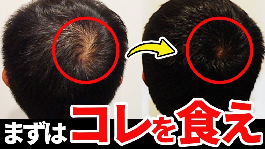 【神コスパ】ファミマで買える!薄毛に効果的な食べ物ベスト3!