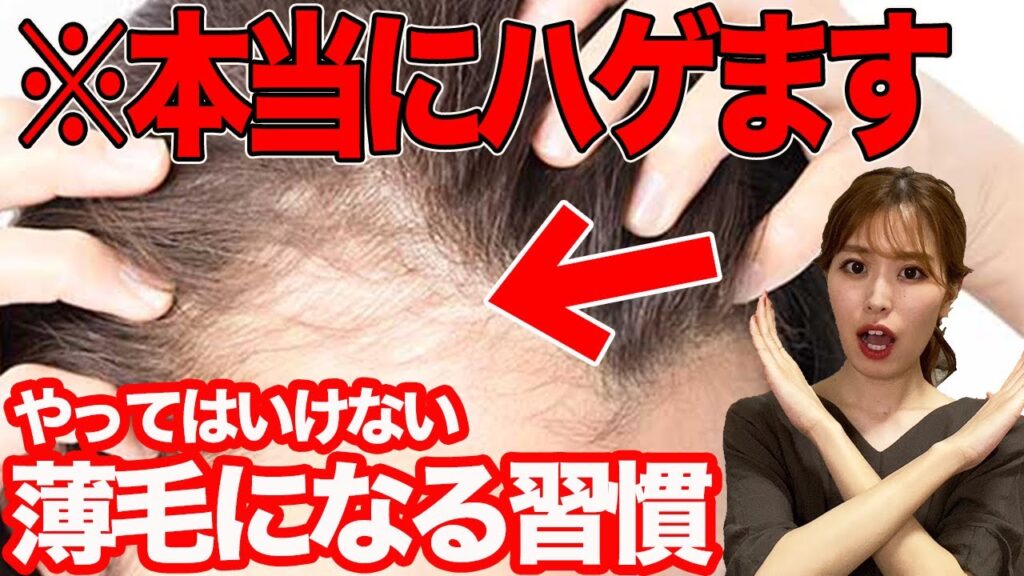 【ハゲ対策】絶対にやってはいけない薄毛になる習慣!