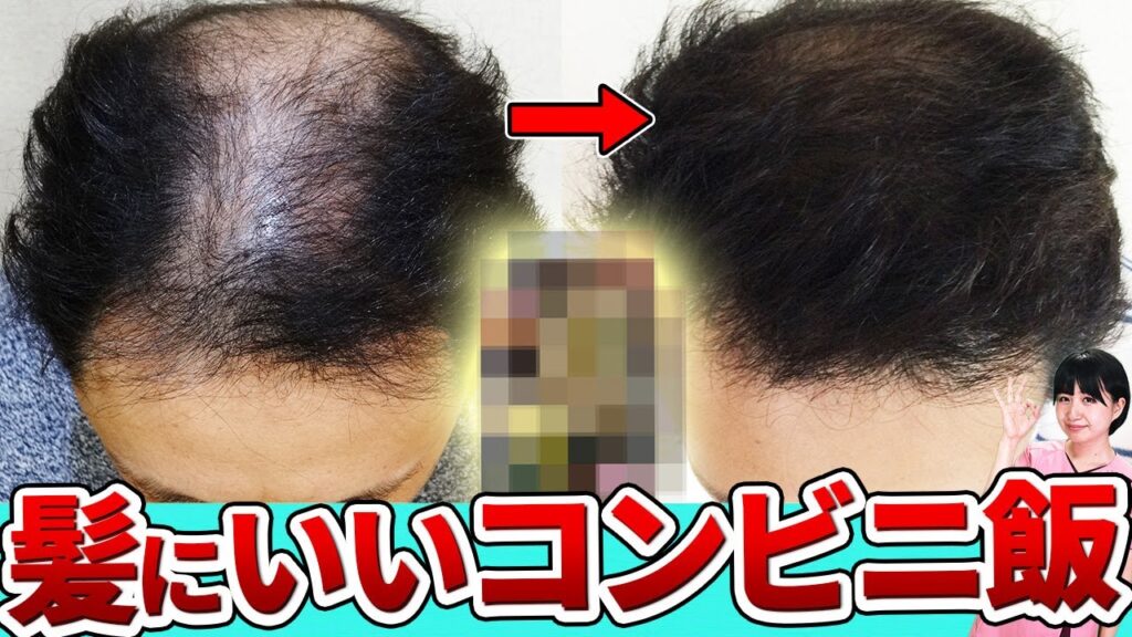 【ワンコイン】コンビニで買える発毛食品3選