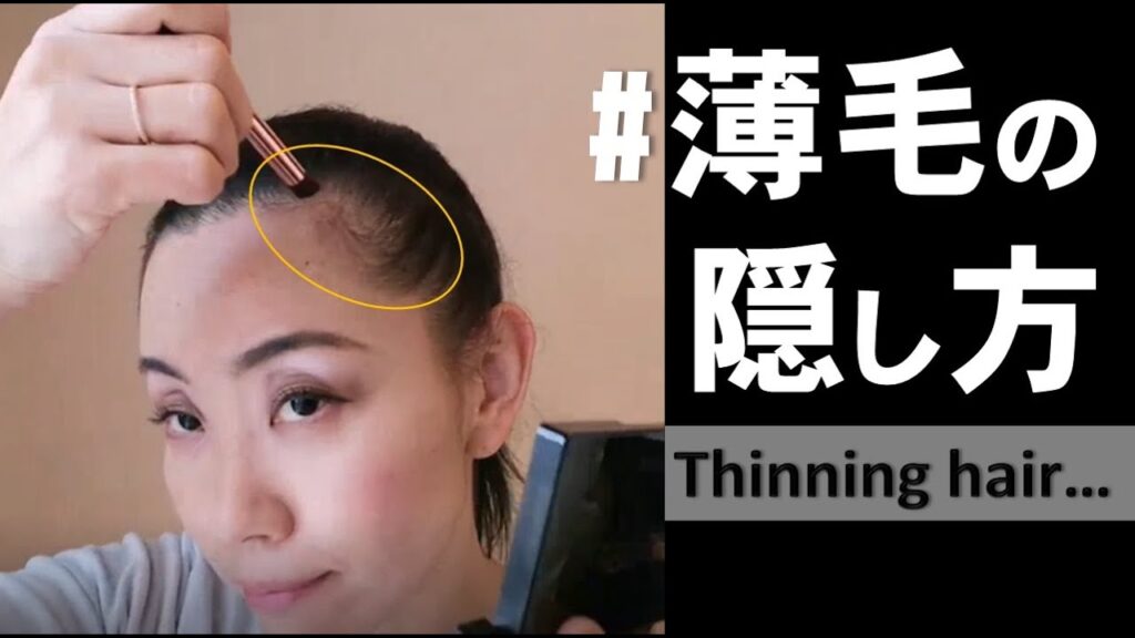 【若魅せテクニック】薄毛 生え際後退の隠し方