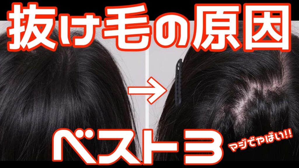 【抜け毛】 髪の毛が抜ける原因ベスト3!!抜けなくなる方法教えます!!