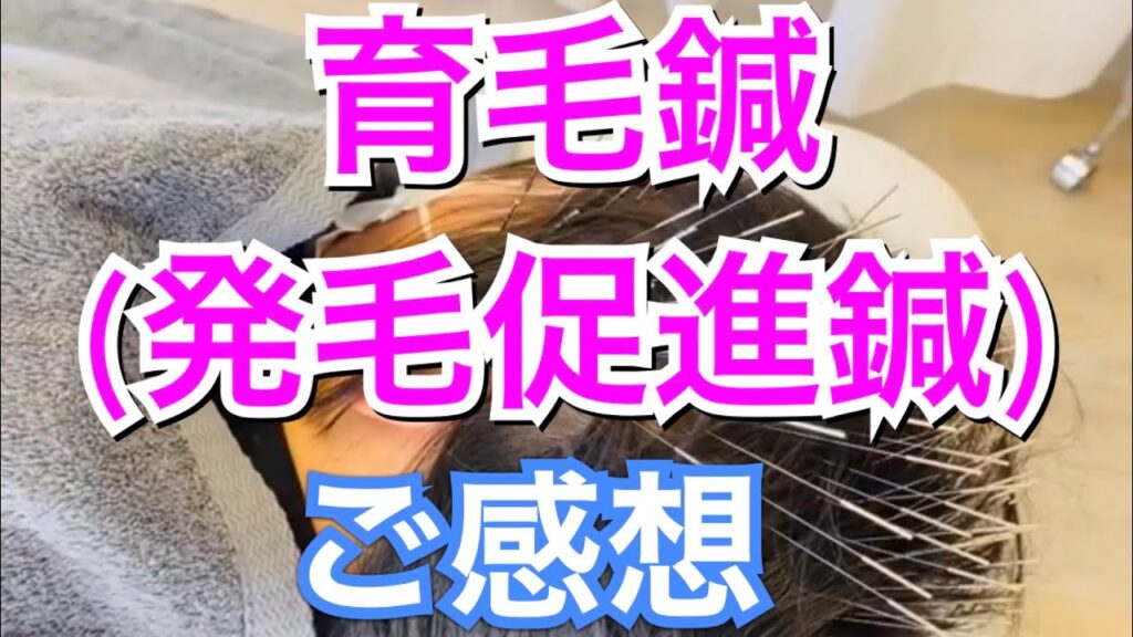 【女性の薄毛/びまん性脱毛症の育毛鍼 (発毛促進)・京都】施術のご感想/脱毛/FAGA/ Crazy鍼灸整体院 烏丸御池院