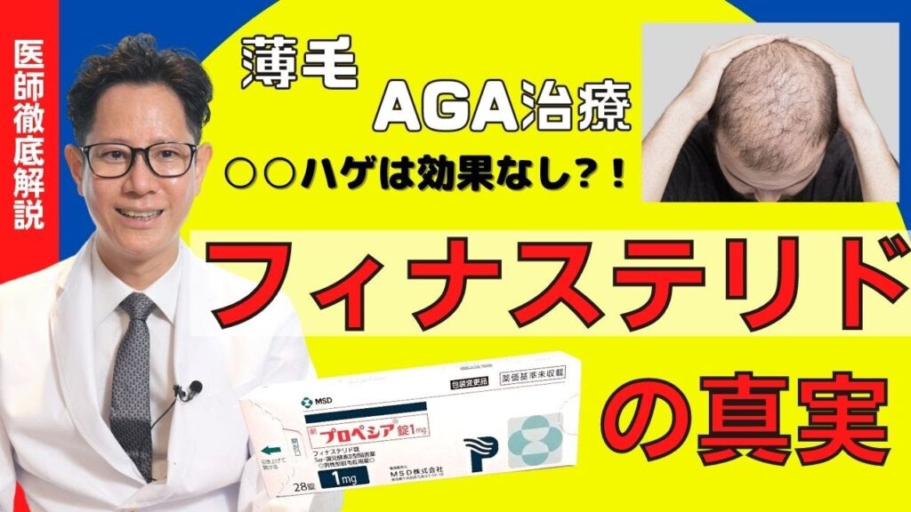 【医師解説】フィナステリドの真実【AGA治療】【薄毛】
