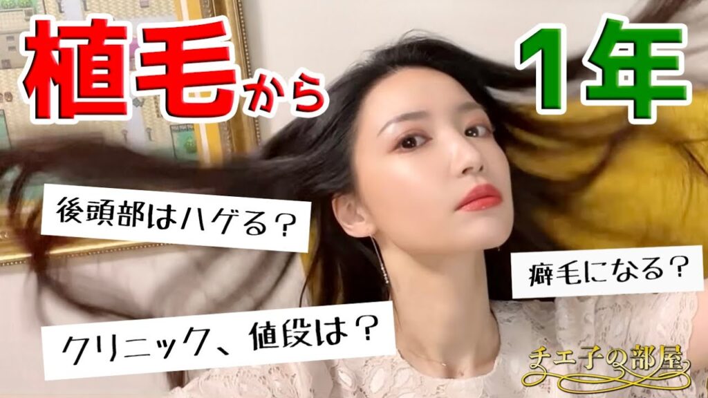 #38 自毛植毛から1年✨よくいただく質問に回答したよ!