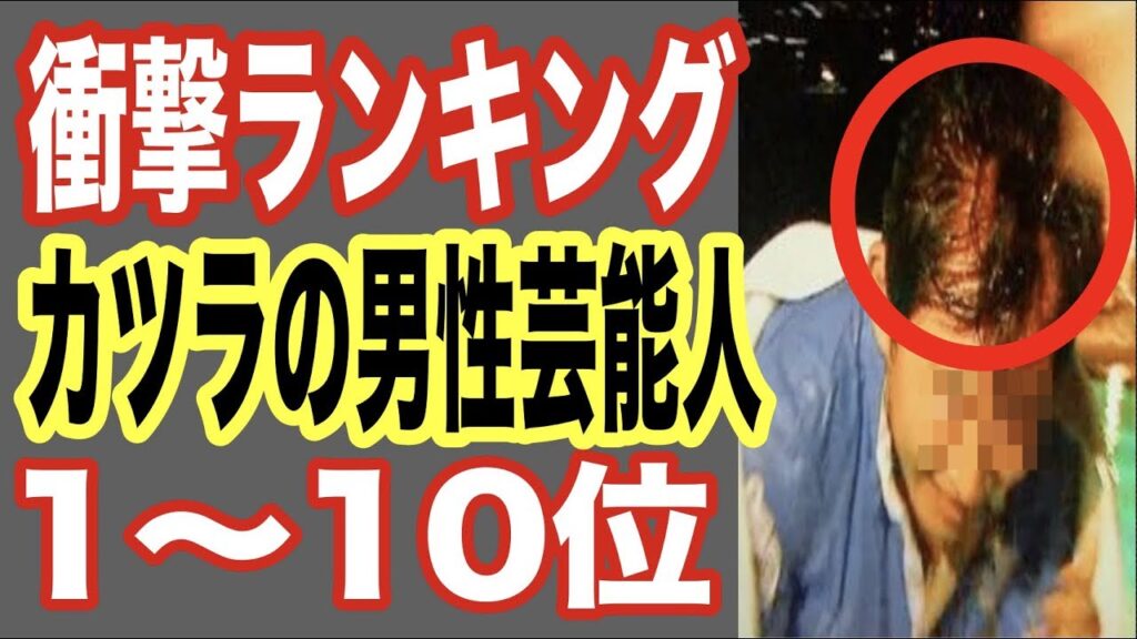 【仰天】カツラの男性芸能人ランキング1-10位!ハゲでかつらをカミングアウトした人も…大物俳優や人気アナウンサーも疑惑画像スキャンダル【世界の果てまで芸能裏情報チャンネル!】
