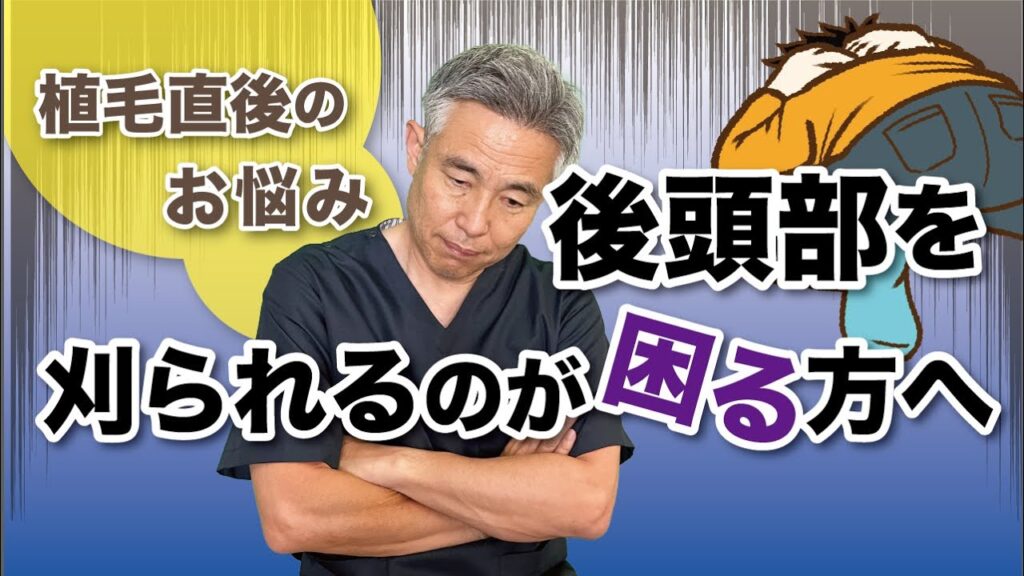 【男性必見!】シートウィッグをつけたら後頭部を隠せます