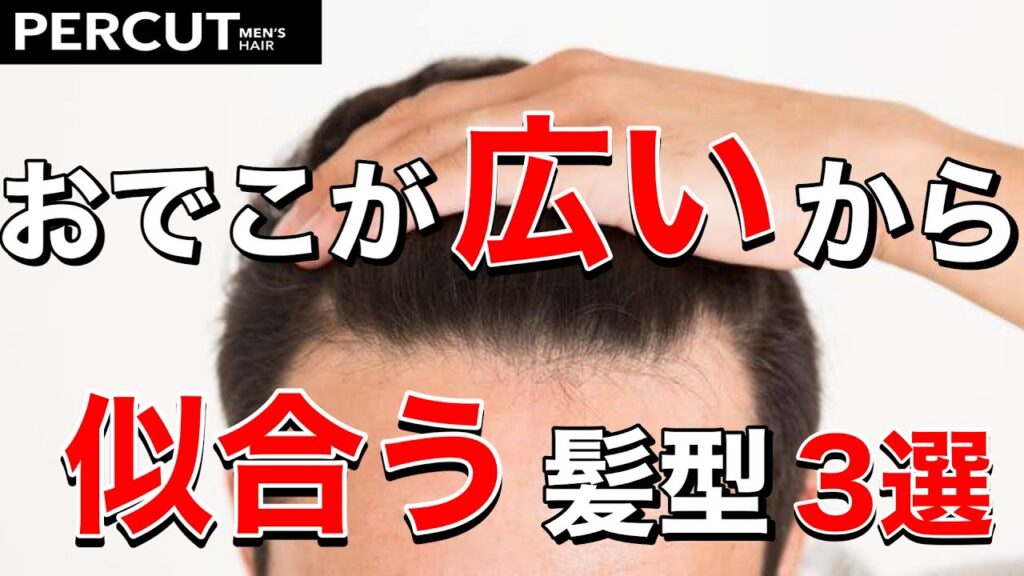 【ハゲ 薄毛】おでこが広いから似合う髪型3選