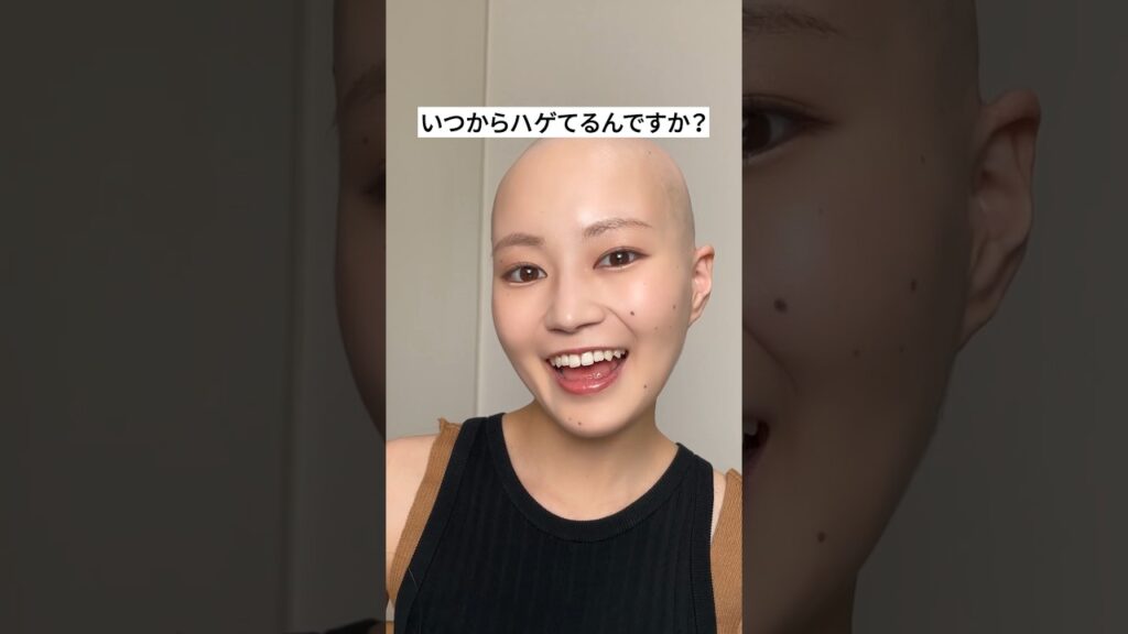 いつからハゲてるんですか? #ウィッグ #脱毛症