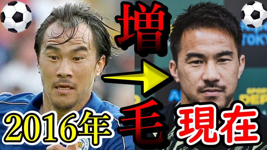 サッカー日本代表『岡崎慎司』がハゲを克服!髪が増えた理由も解説します。
