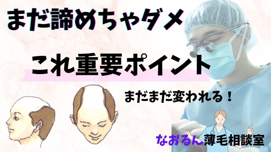 自毛植毛　まだまだ変われる！AGA進行度７型でも諦めないで！