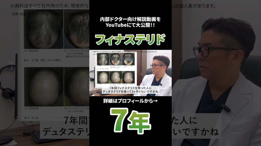 フィナステリドのみ7年内服した結果・・・ #薄毛治療 #AGA治療薬