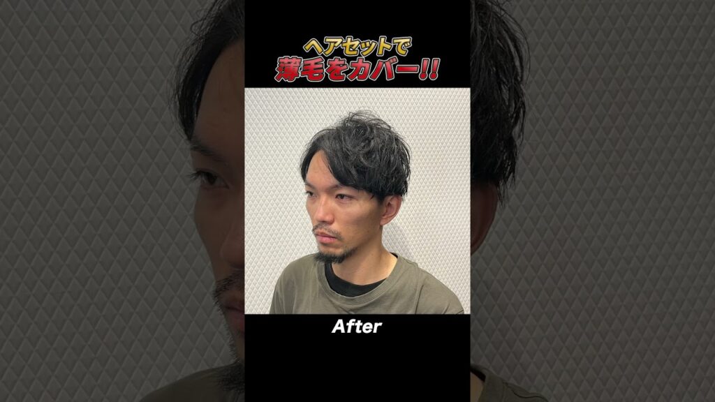 【若ハゲ】ヘアセットで変貌した男性5選!