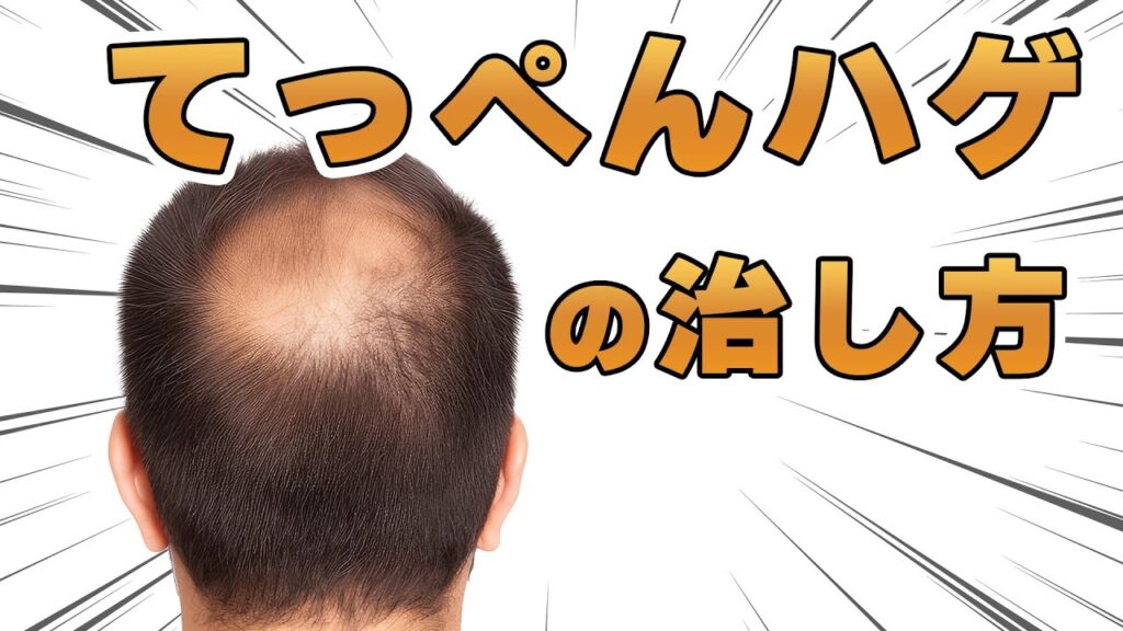 【AGA治療】てっぺんハゲの改善方法や治し方を解説します。