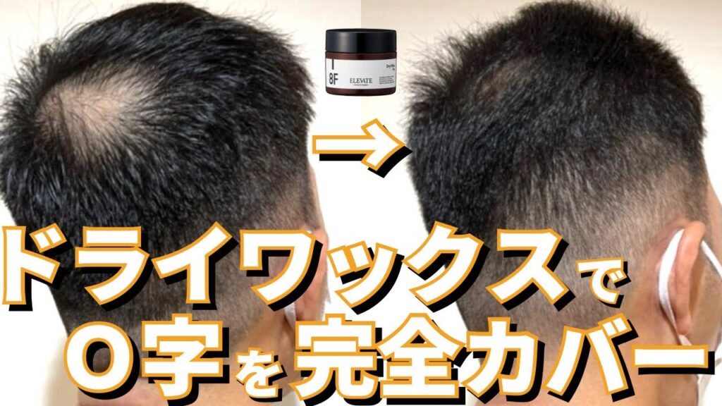 【O字ハゲ】透ける頭頂部をカバーするショートスタイル