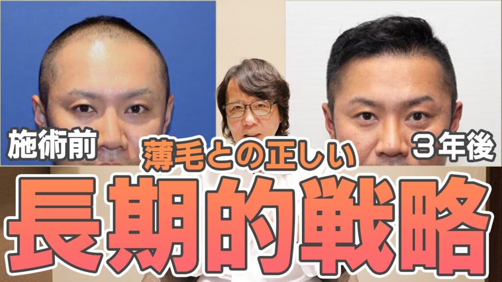 【自毛植毛】薄毛との戦い〜戦略と戦術〜　薄毛治療の専門医が解説いたします。