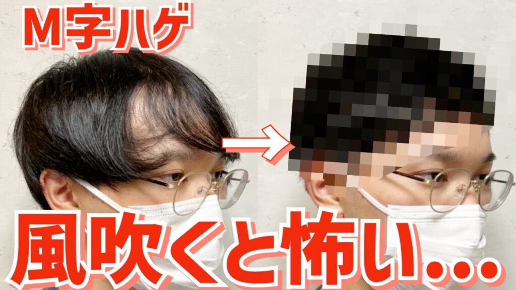 【薄毛】M字ハゲの悩みを解決するプロのカット術！