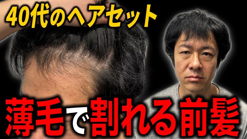 【40代薄毛】髪が薄く、前髪が割れて見えないヘアセットで若返る!