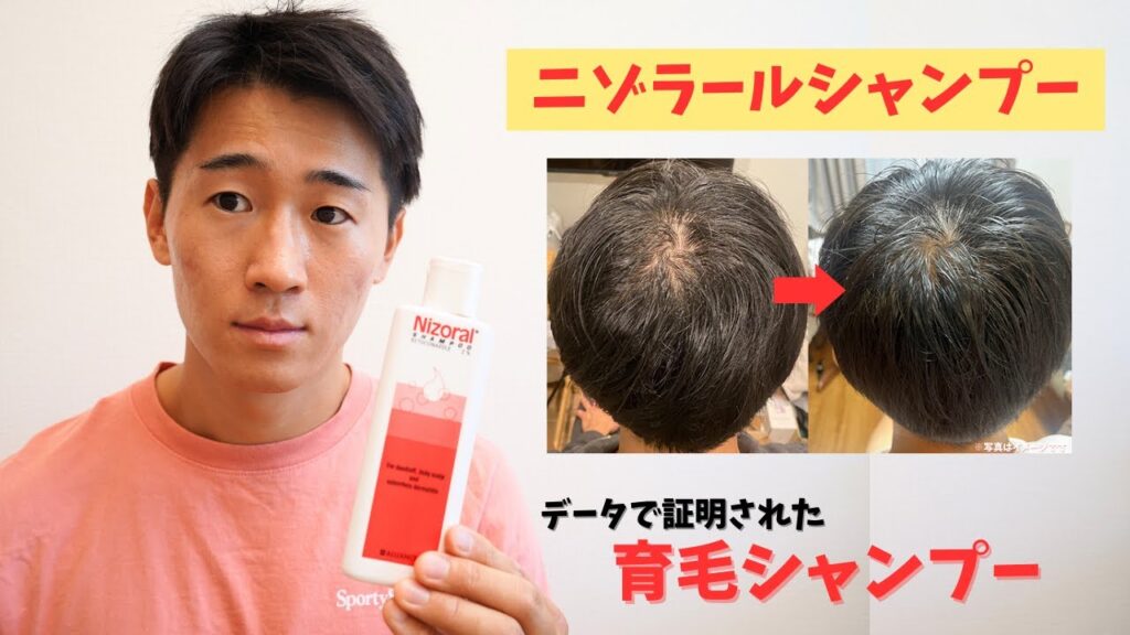 シャンプーで発毛⁈ ケトコナゾール配合ニゾラールシャンプーの効果と使い方とは？