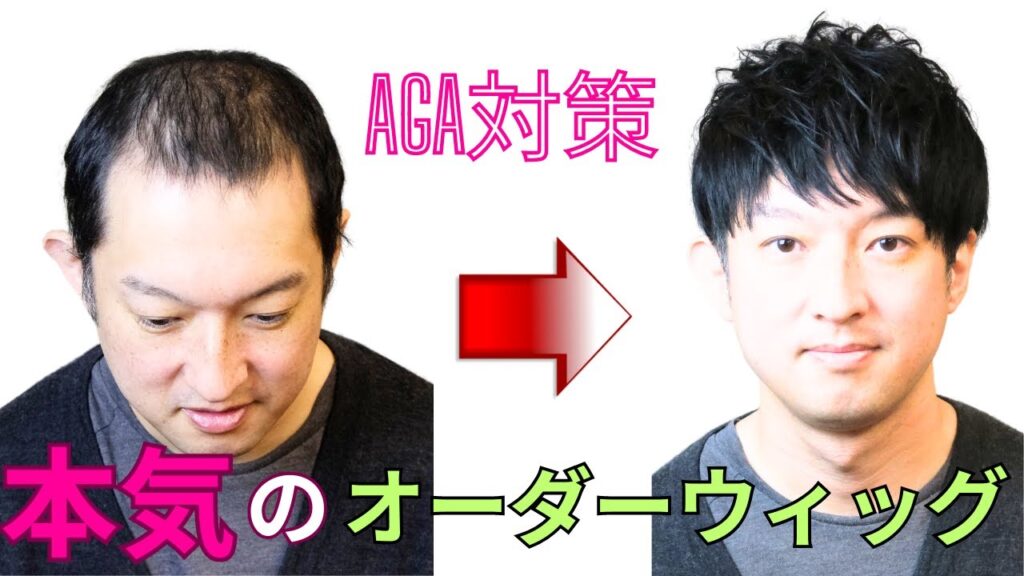 薄毛の男性必見!これが最強のバレないハーフウィッグ。AGA対策に。北海道~沖縄、全国からオーダー制作依頼のあるメンズウィッグ。
