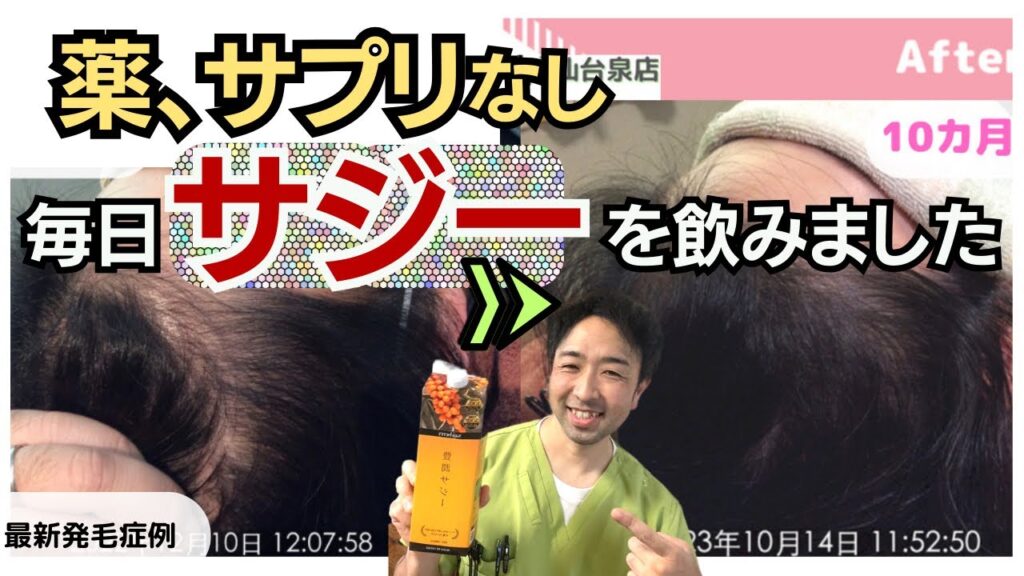 サジーが女性の薄毛改善に効いた！！髪に嬉しい効果や栄養素がたっぷり