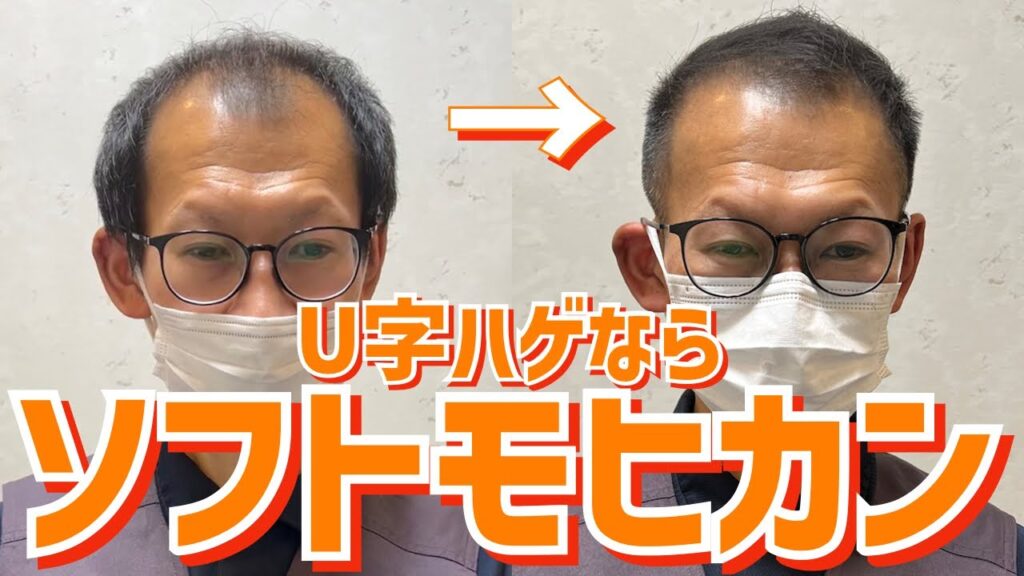 【薄毛】M字頭頂部ハゲをカットでカバー