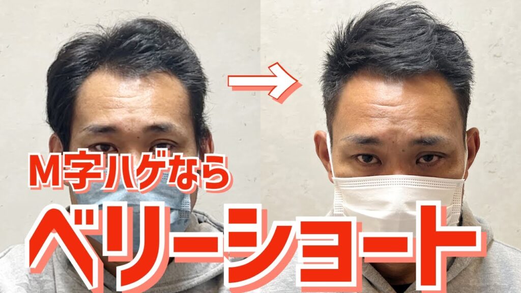 【薄毛】セルフカットの失敗をプロの技術で理想のヘアースタイルに