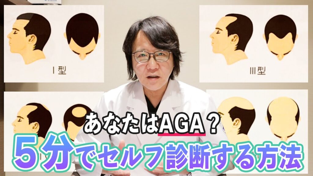 【自毛植毛】5分でできる薄毛(AGA)診断！【植毛】【薄毛治療】