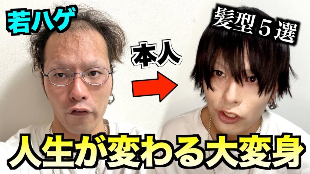 若ハゲが話題の激安ウィッグで人生を変える大変身5選