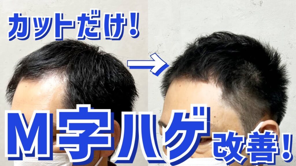 【薄毛】絶対見て！M字はげ・つむじはげをカットでカバー！