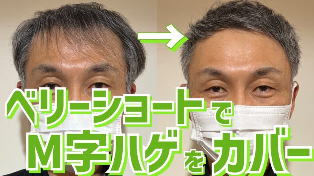 【薄毛】ヘアカットで若返り？M字ハゲをカットでカバー